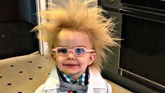 Таралмайдиган сочлар синдроми: “Эйнштейн 2.0” (Фото)