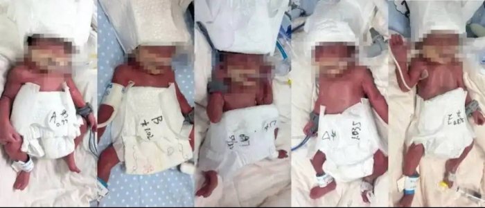 24 ёшли аёл 5 эгизакни дунёга келтирди