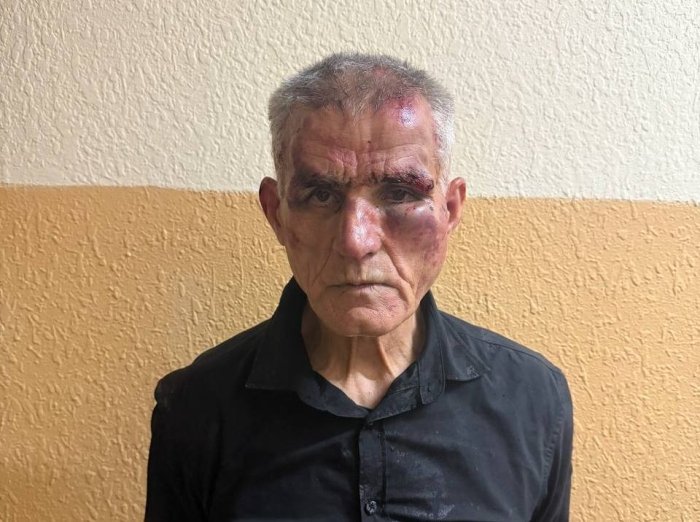 Toshkentda ruhiy kasal erkak ichki ishlar xodimini pichoqladi