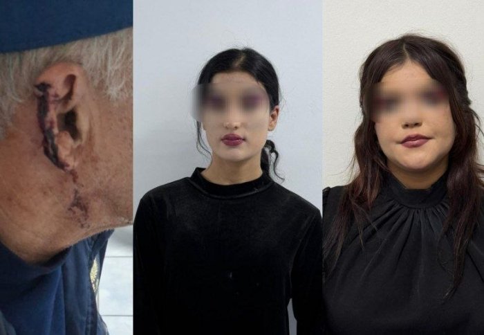 Voyaga yetmagan ikki qiz kirakashni tunab, uning qulog‘ini tishlab oldi