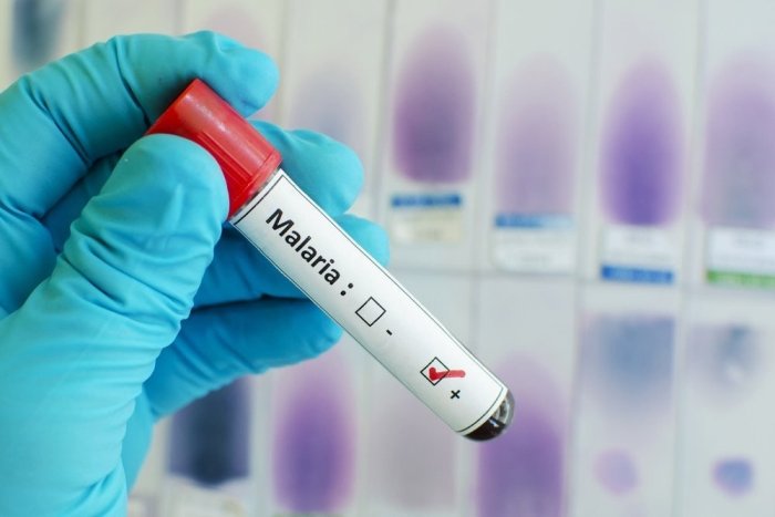 Дунёда безгакдан ўлим ҳолатлари ортмоқда