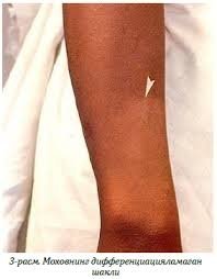 Руминияда 40 йилдан ортиқ вақт ичида биринчи марта мохов касаллиги қайд этилди