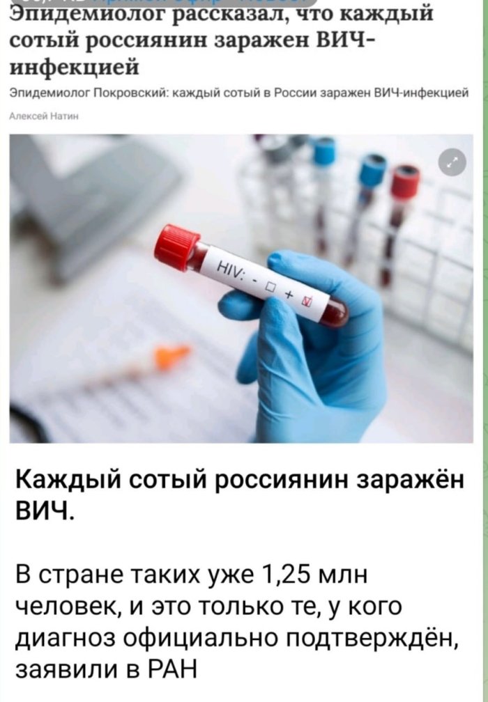 RF Fanlar akademiyasi: «Har yuzta rossiyalikdan bittasi OITS bilan kasallangan»