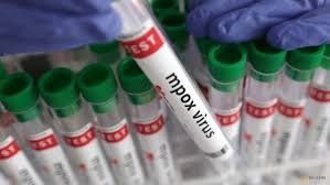 Buyuk Britaniyada xavfli virusning yangi shtammi topildi