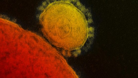 Kutilmagan bayonot: koronavirus odamni o‘ldirishga mo‘ljallanmagan