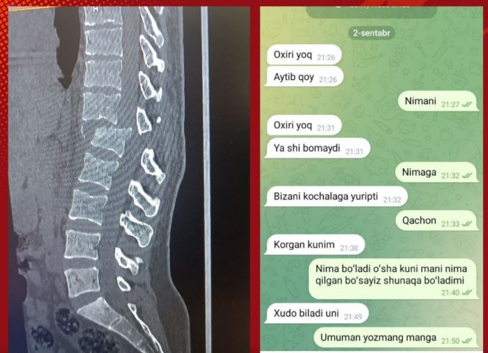 Navoiyda erkak aliment talab qilgan xotinini mashinada bosib ketdi, ayolning umurtqasi sindi