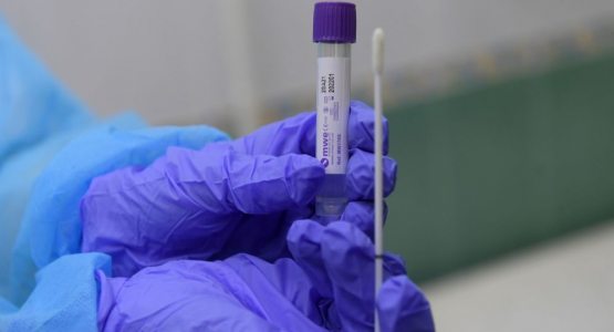 Юртимизда коронавирусга қарши қўлланилган жами вакциналар 17,4 миллион дозадан ошди
