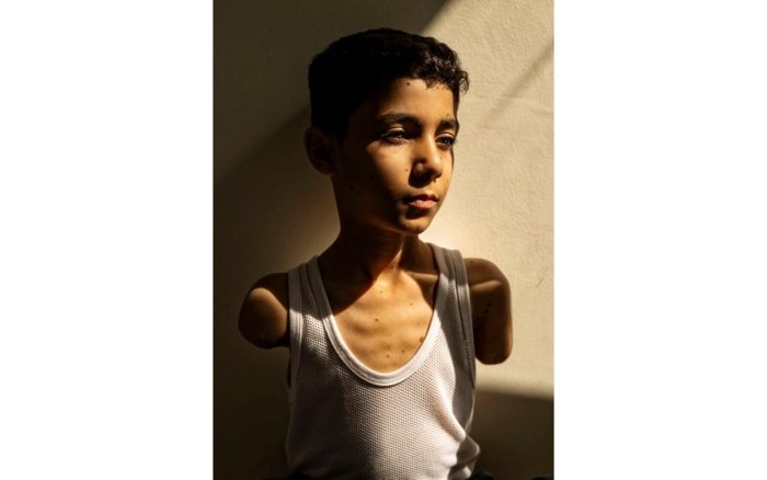 Фаластинлик ногирон боланинг сурати World Press Photo йилнинг энг яхши ғолиби бўлди