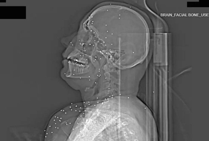 Эрон хавфсизлик кучлари норозилик намойишчиларига нисбатан ўқотар қуроллардан фойдаланган