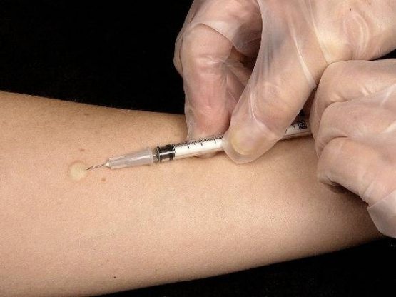 Ўзбекистонликлар сохта вакцина билан эмланяптими? (ВИДЕО)
