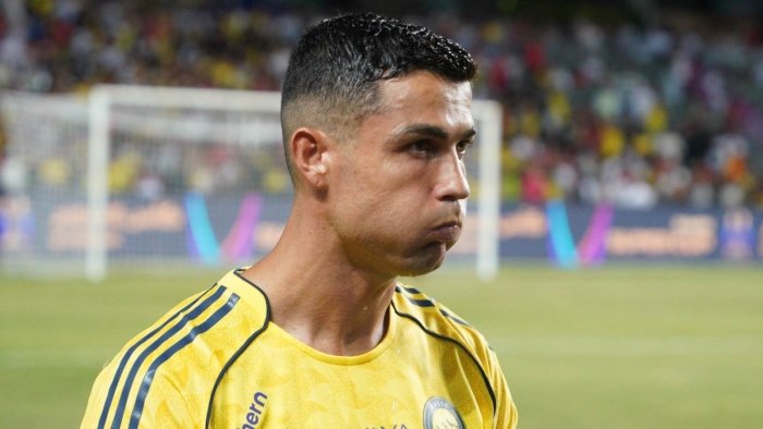 Ronalduning jarohati jiddiy bo‘lib chiqdi