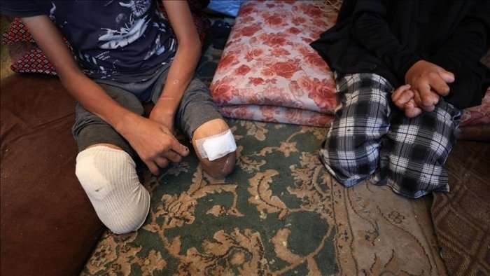 Ғазо дунёдаги энг кўп ногирон болаларга эга