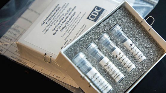 Коронавирус: Хитойнинг Испанияга берган тестлари сифатсиз бўлиб чиқди