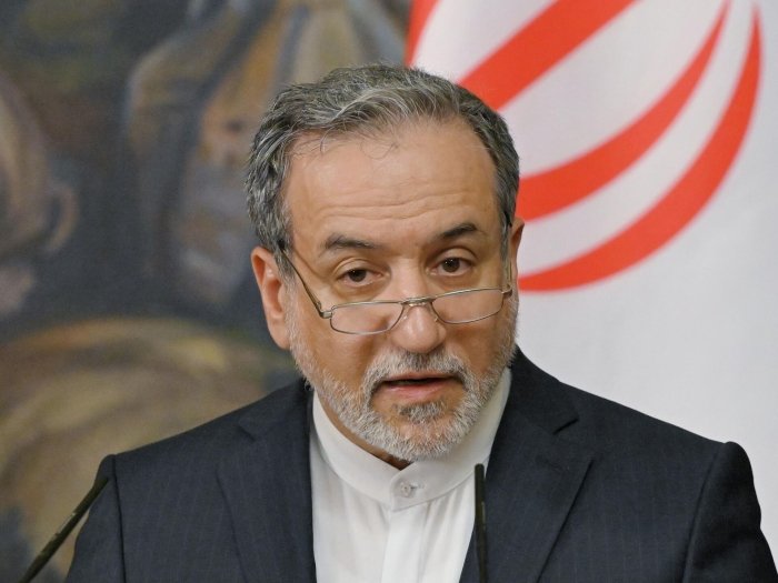 Эрон олий раҳбарининг саломатлиги ҳақида хабар берилди