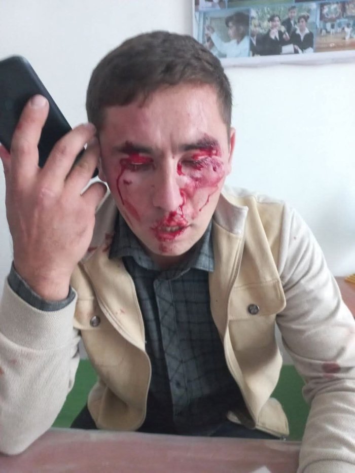 Самарқанддаги мактабда яна ўқитувчилар аёвсиз дўппосланди Самарқанддаги мактабда яна ўқитувчилар аёвсиз дўппосланди