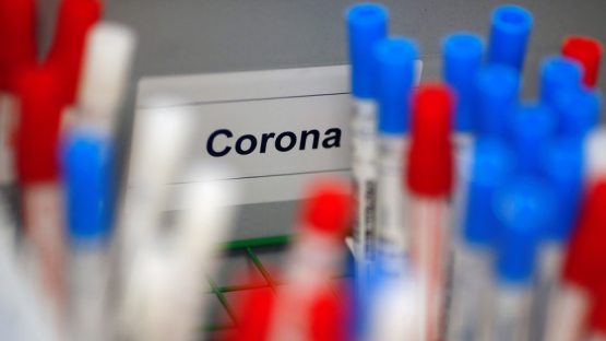 Jizzaxda  “Mahalla va oilani qo‘llab quvvatlash markazi” xodimida koronavirus aniqlandi