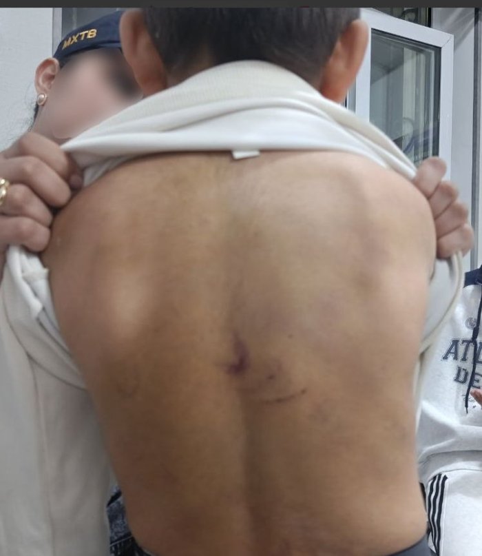 Toshkentda talaba yigit 9 nafar bolaga tazyiq o‘tkazib kelgani aniqlandi