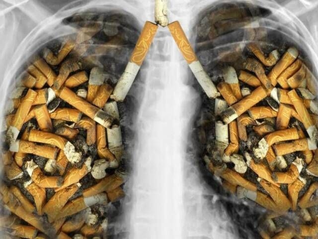 JSST: Sigaret tutuni har to‘rt soniyada bir kishining hayotiga nuqta qo‘ymoqda