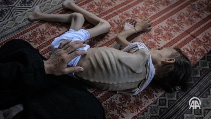 G‘azo sektorida ochlik qurbonlari soni oshib bormoqda