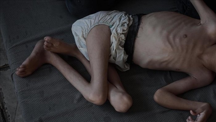 Bir kunda qamal ostidagi G‘azoda yana olti kishi, jumladan bir bola ochlikdan halok bo‘ldi