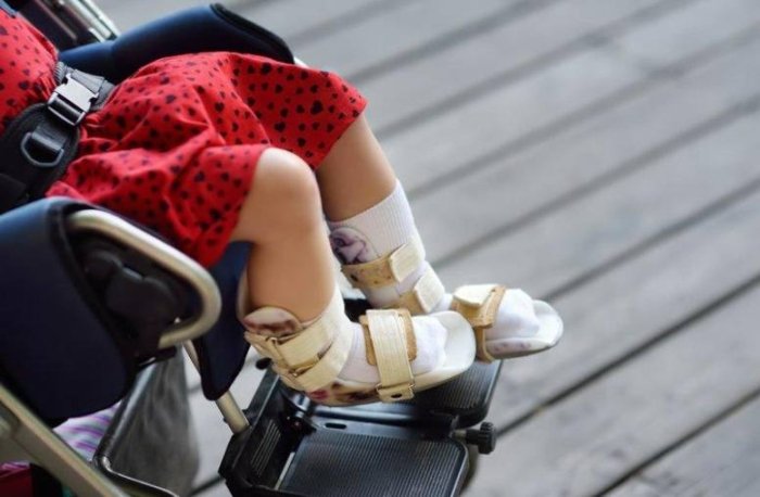 Spinal mushak atrofiyasi tashxisi qo‘yilgan bolalar uyda davolanish uchun zarur jihozlar bilan ta’minlanadi